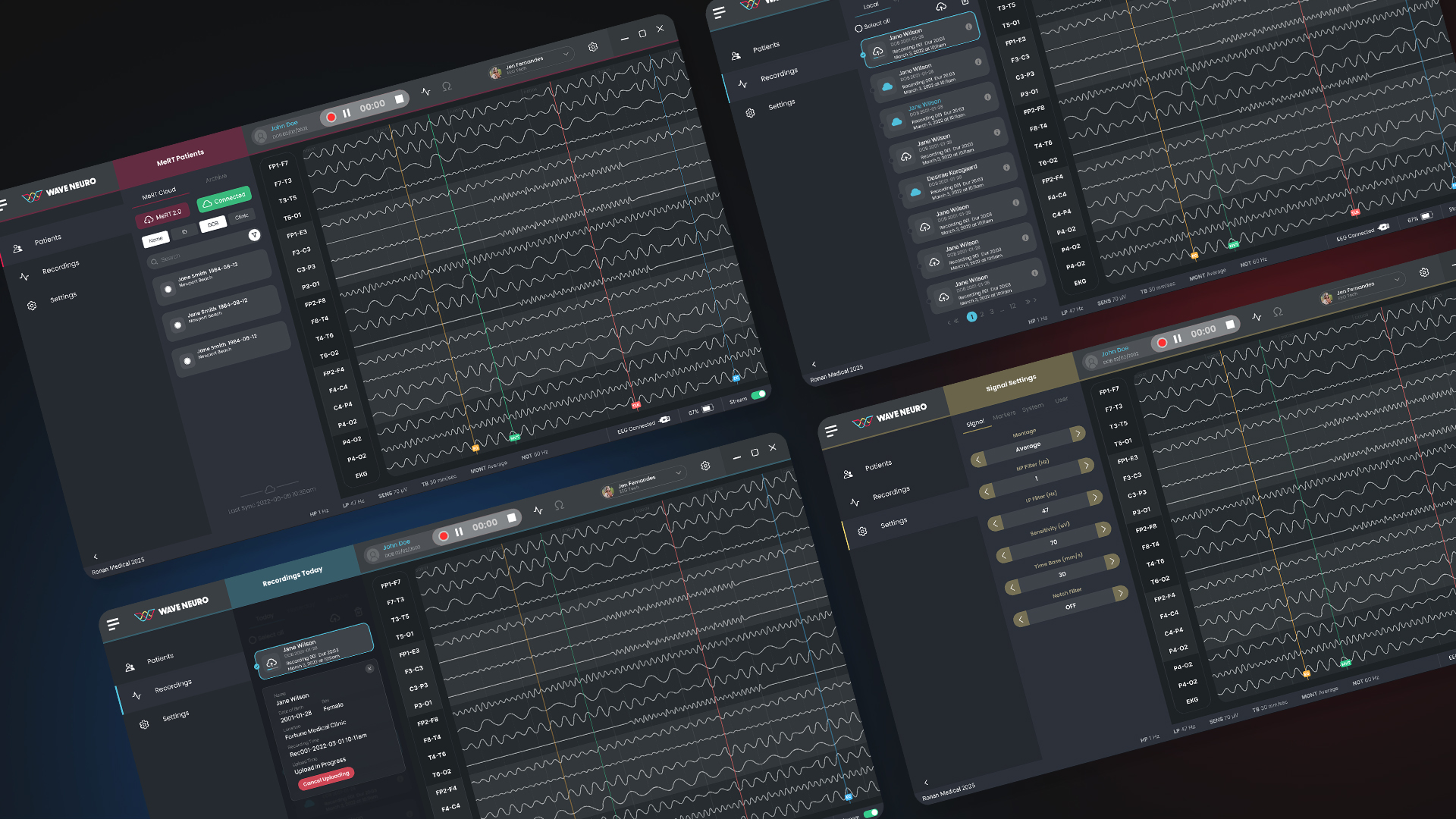 WaveNeuro patients, recordings, upload status and signal settings screens shown together