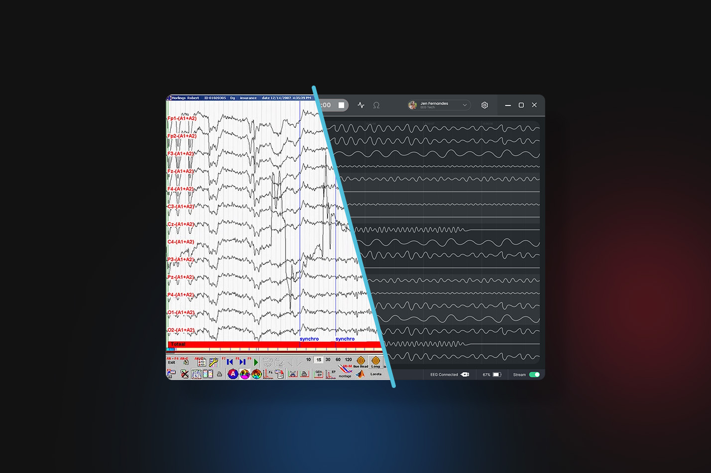 Comparison of the legacy EEG interface and the WaveNeuro signal workspace